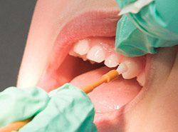 Fluoride application
